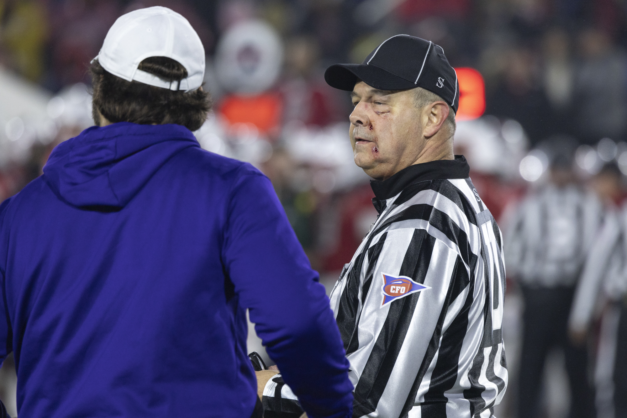 Dec. 28, 2024: Game Official Rod Tucker received minor injuries...